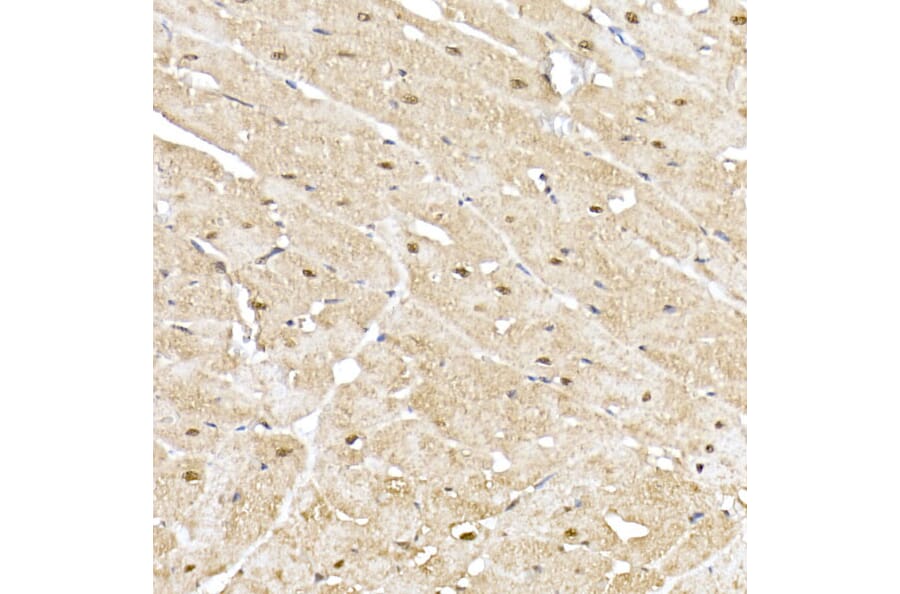Immunohistochemistry - Anti-Proteasome 20S alpha 5/PSMA5 Antibody (A14951) - Antibodies.com