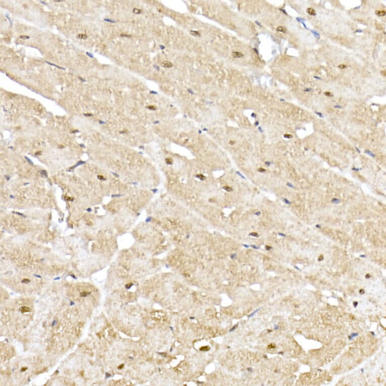 Immunohistochemistry - Anti-Proteasome 20S alpha 5/PSMA5 Antibody (A14951) - Antibodies.com