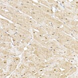 Immunohistochemistry - Anti-Proteasome 20S alpha 5/PSMA5 Antibody (A14951) - Antibodies.com