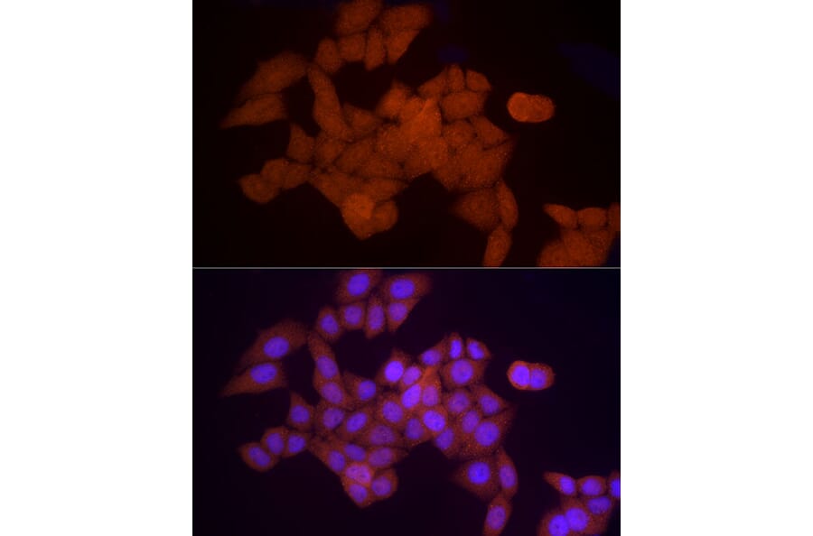 Immunofluorescence - Anti-Proteasome 20S alpha 5/PSMA5 Antibody (A14951) - Antibodies.com