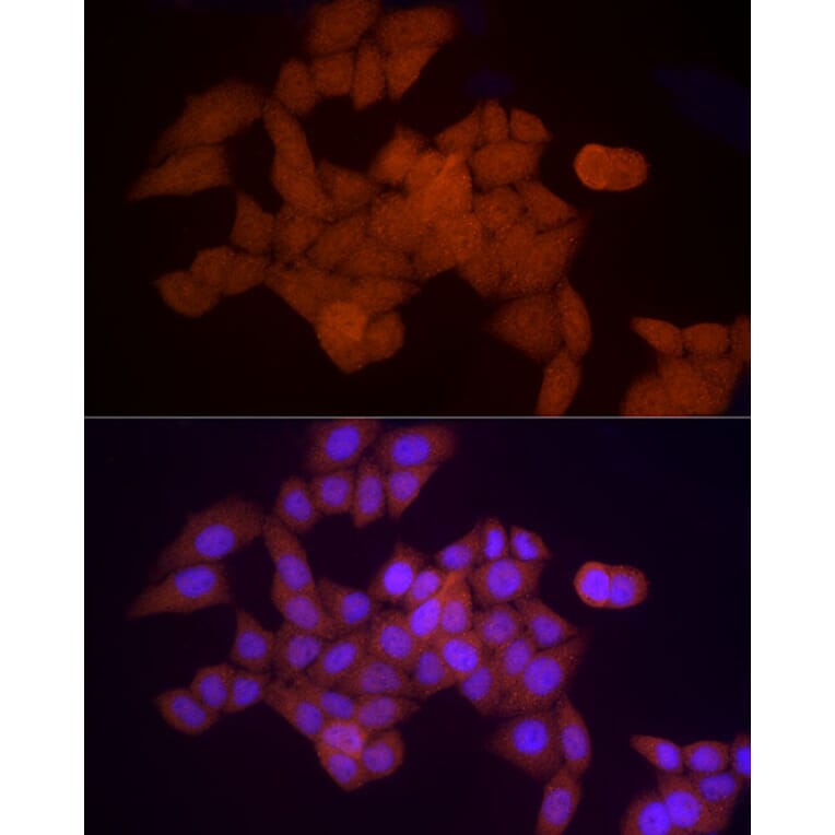 Immunofluorescence - Anti-Proteasome 20S alpha 5/PSMA5 Antibody (A14951) - Antibodies.com