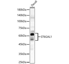 Western Blot - Anti-CD75 Antibody (A14952) - Antibodies.com