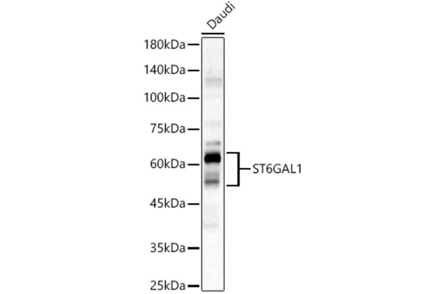 Western Blot - Anti-CD75 Antibody (A14952) - Antibodies.com