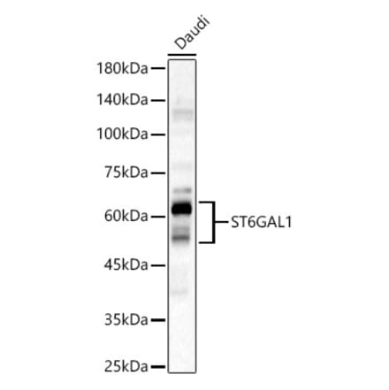 Western Blot - Anti-CD75 Antibody (A14952) - Antibodies.com