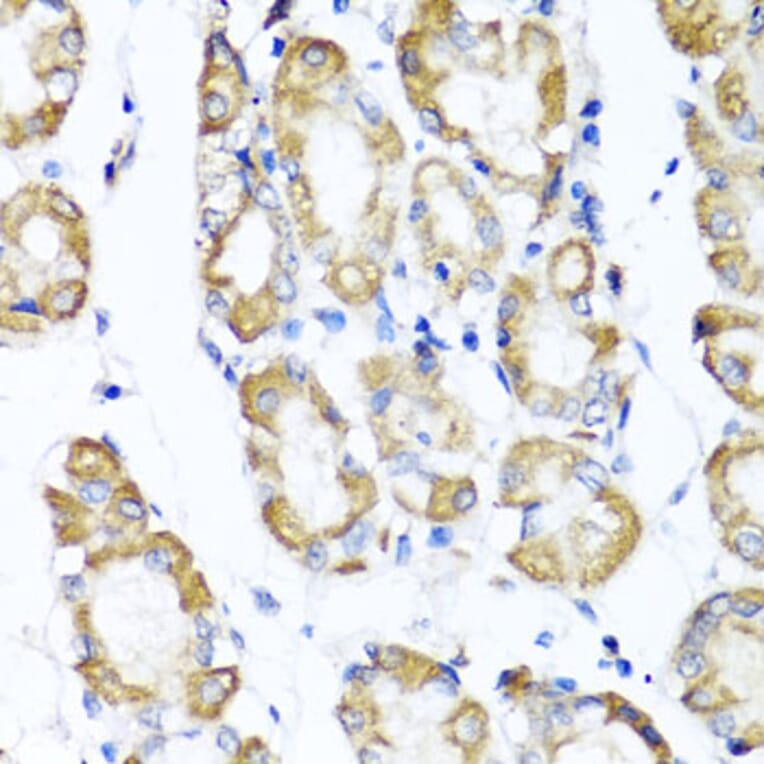 Immunohistochemistry - Anti-CD75 Antibody (A14952) - Antibodies.com