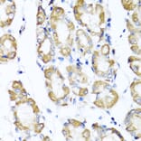 Immunohistochemistry - Anti-CD75 Antibody (A14952) - Antibodies.com