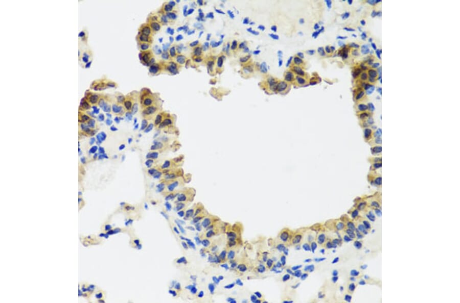 Immunohistochemistry - Anti-CD75 Antibody (A14952) - Antibodies.com