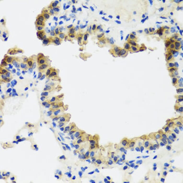Immunohistochemistry - Anti-CD75 Antibody (A14952) - Antibodies.com