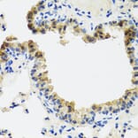 Immunohistochemistry - Anti-CD75 Antibody (A14952) - Antibodies.com