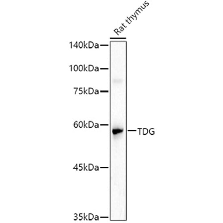 Western Blot - Anti-TDG Antibody (A14953) - Antibodies.com