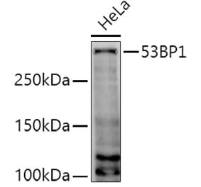 Western Blot - Anti-53BP1 Antibody (A14954) - Antibodies.com