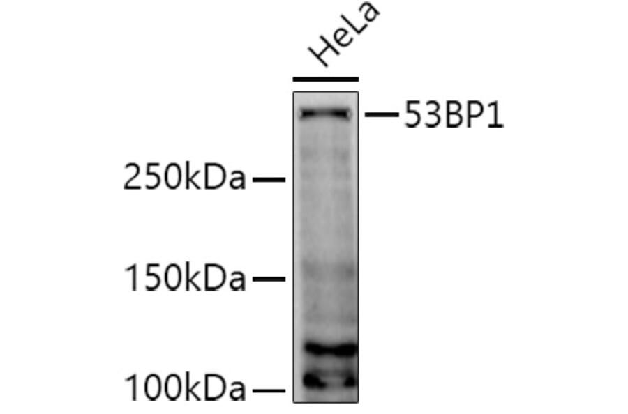 Western Blot - Anti-53BP1 Antibody (A14954) - Antibodies.com