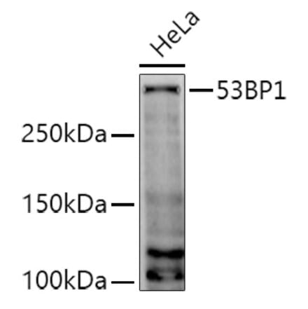 Western Blot - Anti-53BP1 Antibody (A14954) - Antibodies.com