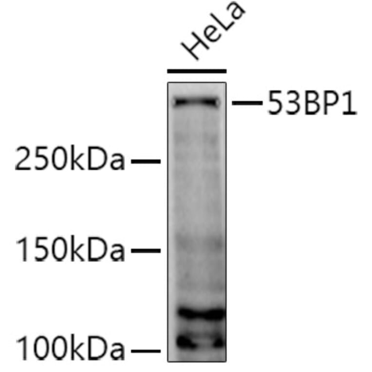 Western Blot - Anti-53BP1 Antibody (A14954) - Antibodies.com