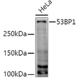 Western Blot - Anti-53BP1 Antibody (A14954) - Antibodies.com