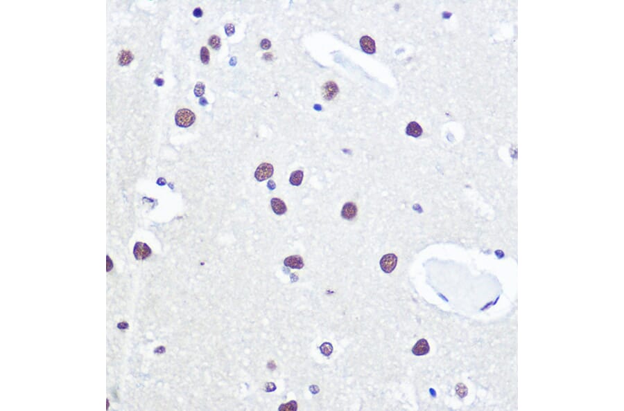 Immunohistochemistry - Anti-53BP1 Antibody (A14954) - Antibodies.com