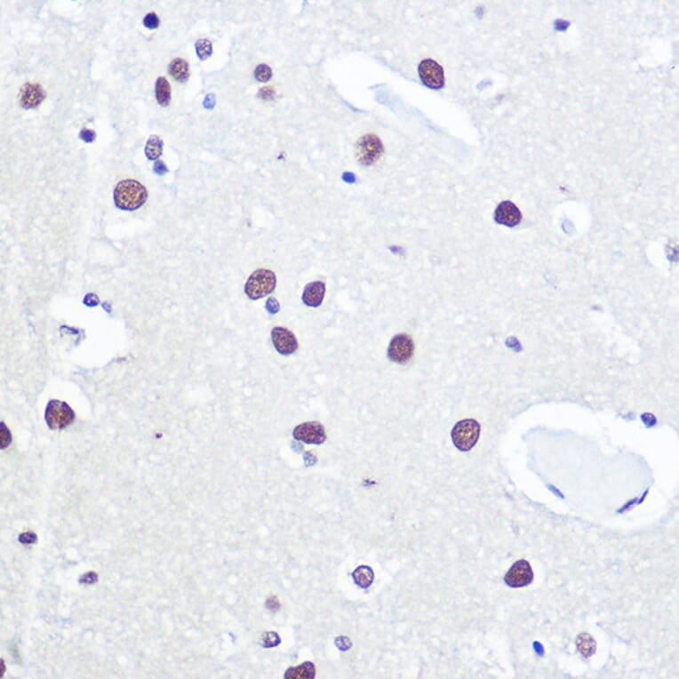 Immunohistochemistry - Anti-53BP1 Antibody (A14954) - Antibodies.com