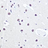 Immunohistochemistry - Anti-53BP1 Antibody (A14954) - Antibodies.com