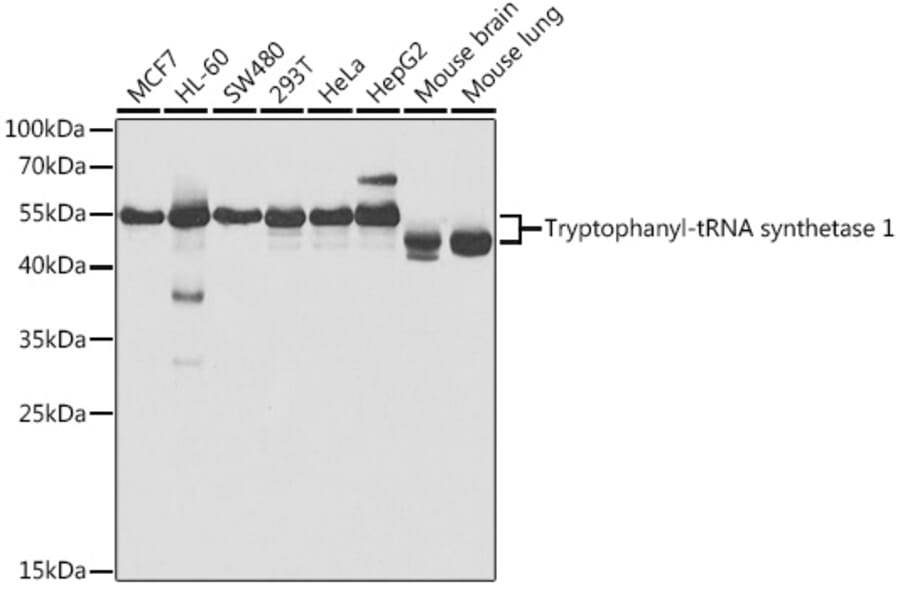 Western Blot - Anti-Tryptophanyl tRNA synthetase/WRS Antibody (A14955) - Antibodies.com