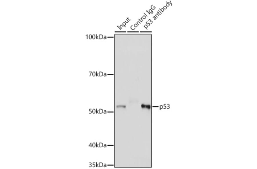 Western Blot - Anti-p53 Antibody (A14956) - Antibodies.com