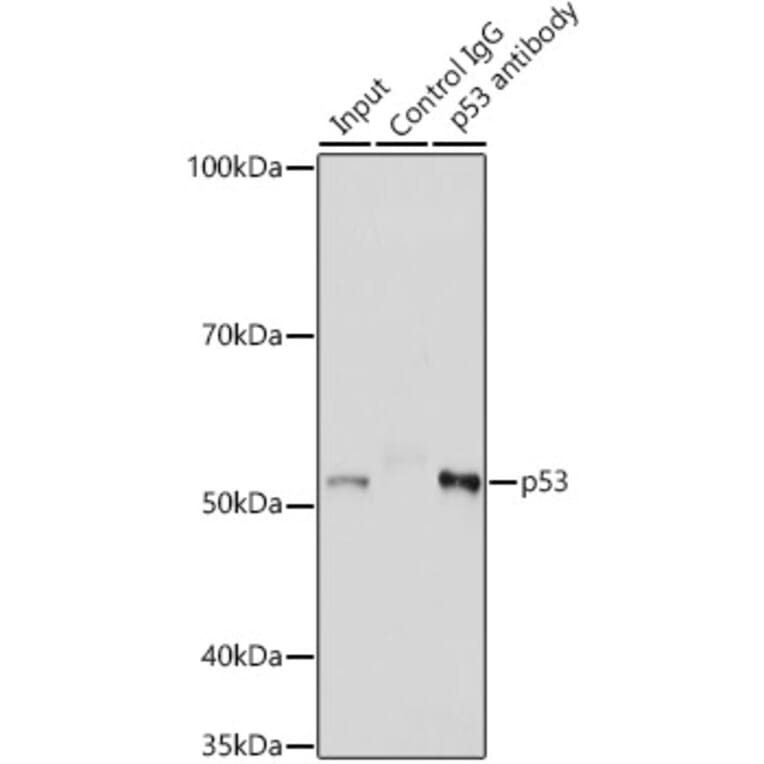 Western Blot - Anti-p53 Antibody (A14956) - Antibodies.com