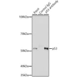 Western Blot - Anti-p53 Antibody (A14956) - Antibodies.com