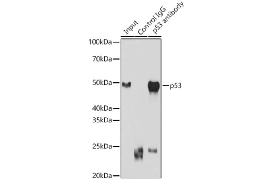 Western Blot - Anti-p53 Antibody (A14956) - Antibodies.com
