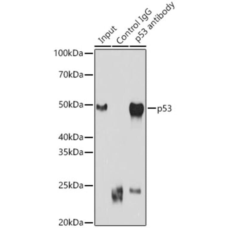 Western Blot - Anti-p53 Antibody (A14956) - Antibodies.com