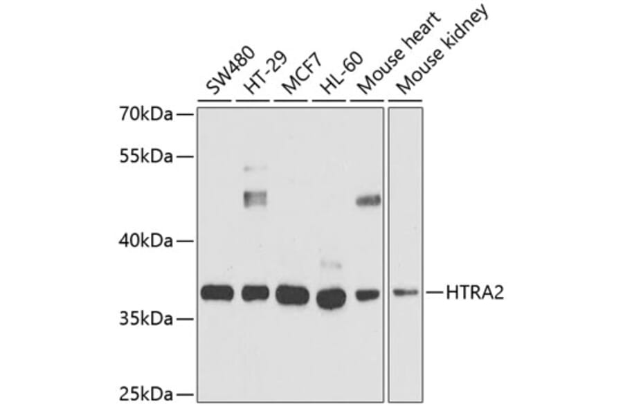 Western Blot - Anti-HTRA2 Antibody (A5762) - Antibodies.com