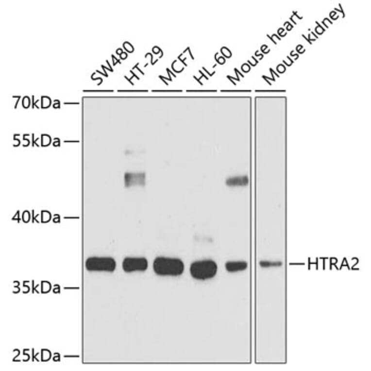 Western Blot - Anti-HTRA2 Antibody (A5762) - Antibodies.com