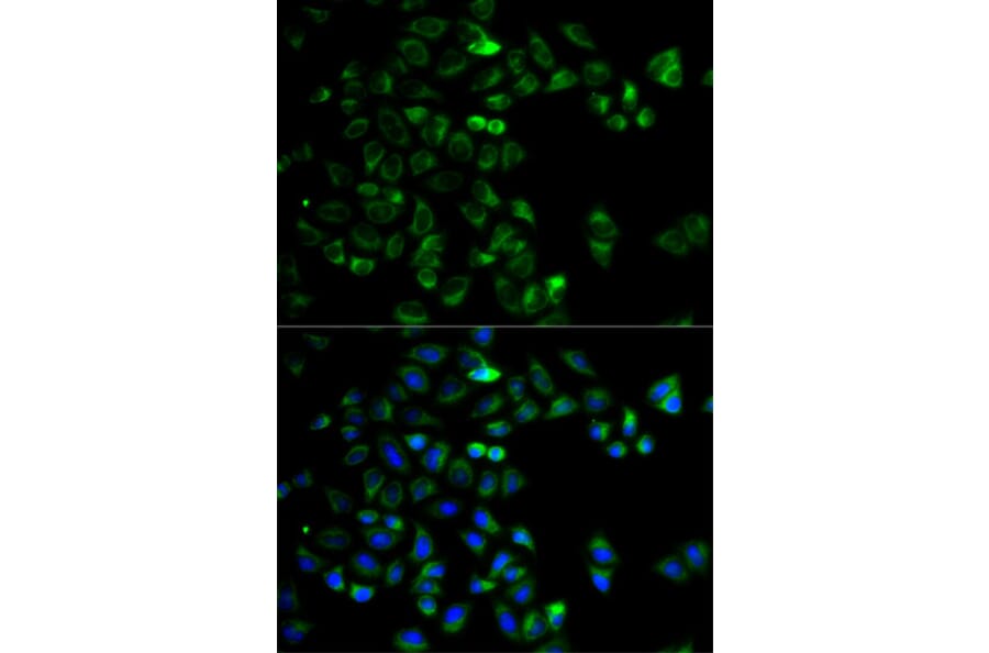 Immunofluorescence - Anti-HTRA2 Antibody (A5762) - Antibodies.com