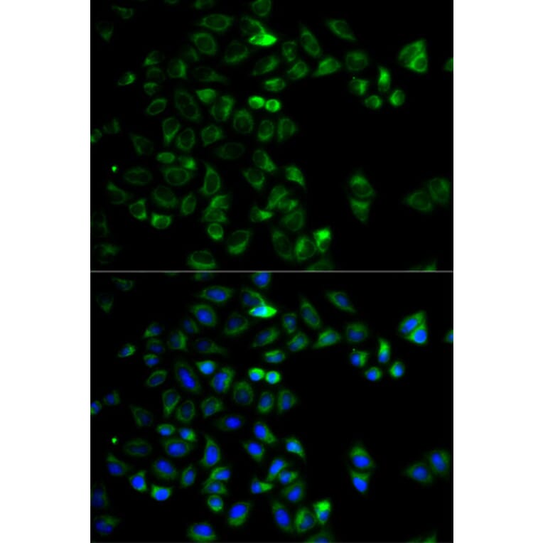 Immunofluorescence - Anti-HTRA2 Antibody (A5762) - Antibodies.com