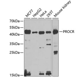 Western Blot - Anti-EPCR/CD201 Antibody (A14958) - Antibodies.com
