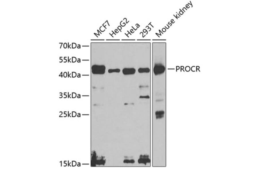 Western Blot - Anti-EPCR/CD201 Antibody (A14958) - Antibodies.com