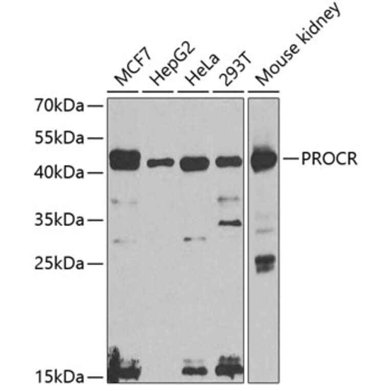 Western Blot - Anti-EPCR/CD201 Antibody (A14958) - Antibodies.com