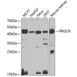 Western Blot - Anti-EPCR/CD201 Antibody (A14958) - Antibodies.com
