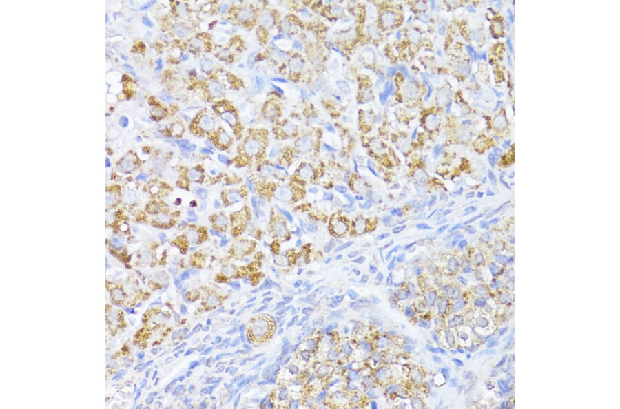Immunohistochemistry - Anti-MAVS Antibody (A14959) - Antibodies.com
