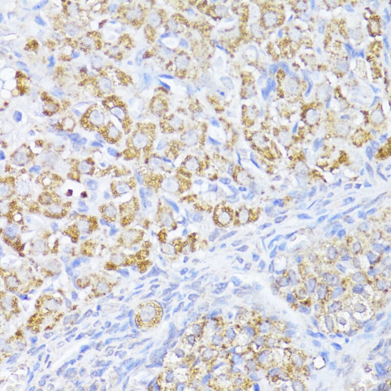 Immunohistochemistry - Anti-MAVS Antibody (A14959) - Antibodies.com
