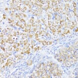 Immunohistochemistry - Anti-MAVS Antibody (A14959) - Antibodies.com