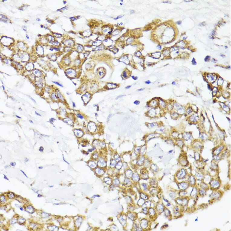 Immunohistochemistry - Anti-MAVS Antibody (A14959) - Antibodies.com