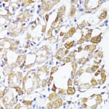 Immunohistochemistry - Anti-MAVS Antibody (A14959) - Antibodies.com