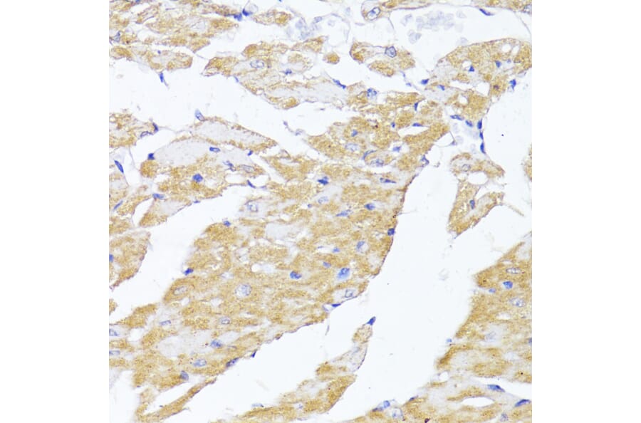 Immunohistochemistry - Anti-MAVS Antibody (A14959) - Antibodies.com