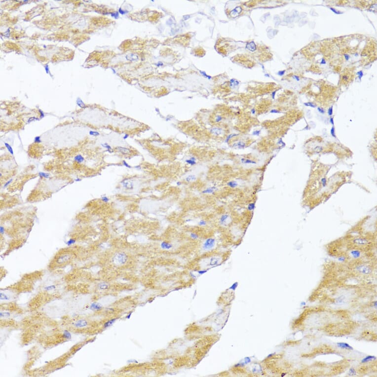 Immunohistochemistry - Anti-MAVS Antibody (A14959) - Antibodies.com