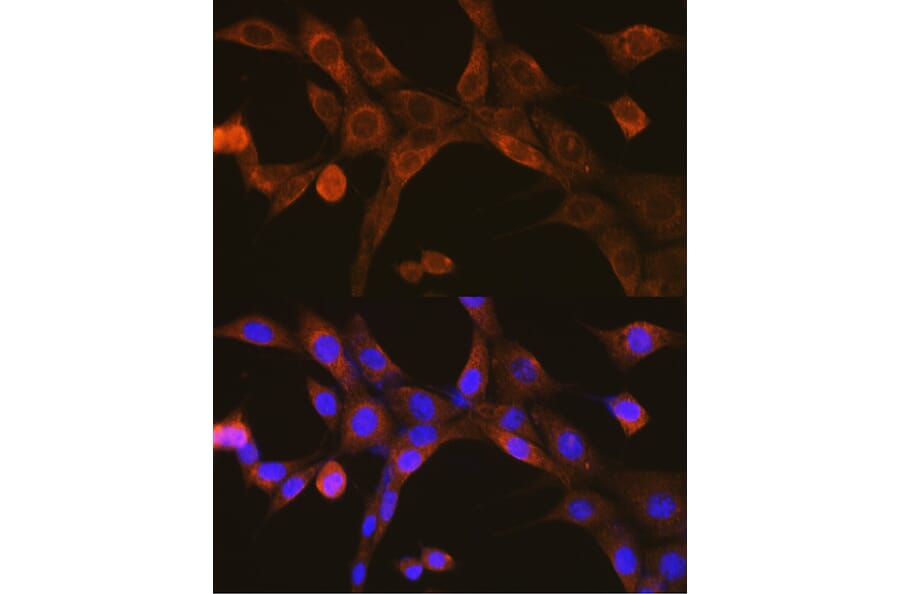 Immunofluorescence - Anti-MAVS Antibody (A14959) - Antibodies.com