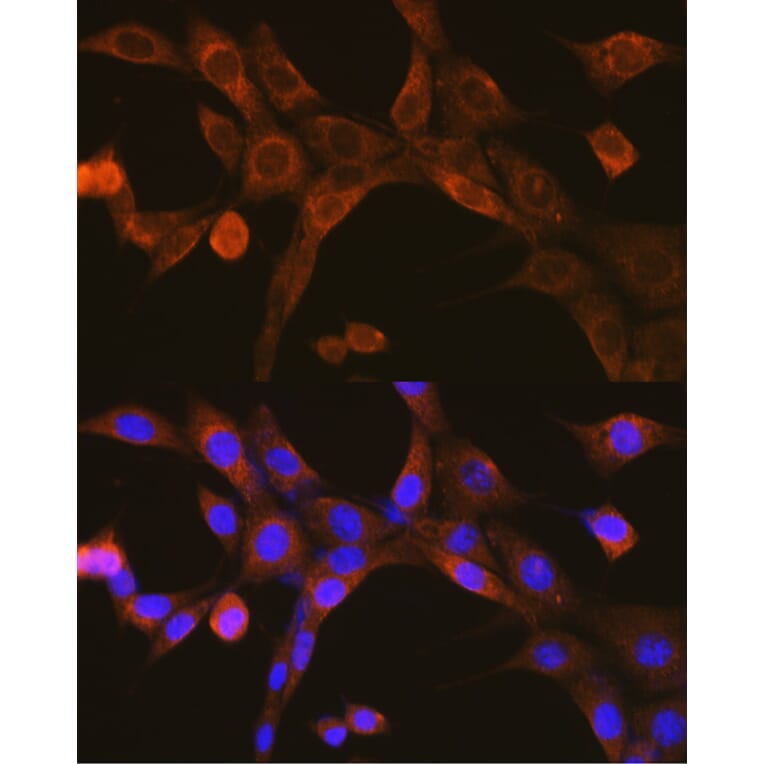 Immunofluorescence - Anti-MAVS Antibody (A14959) - Antibodies.com