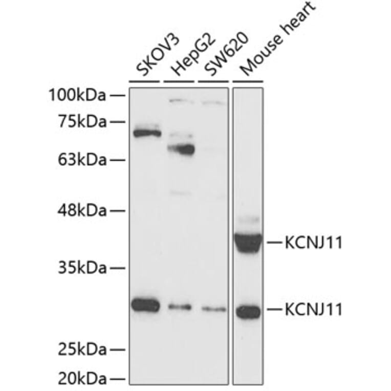 Western Blot - Anti-Kir6.2/BIR Antibody (A14960) - Antibodies.com
