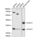 Western Blot - Anti-Kir6.2/BIR Antibody (A14960) - Antibodies.com