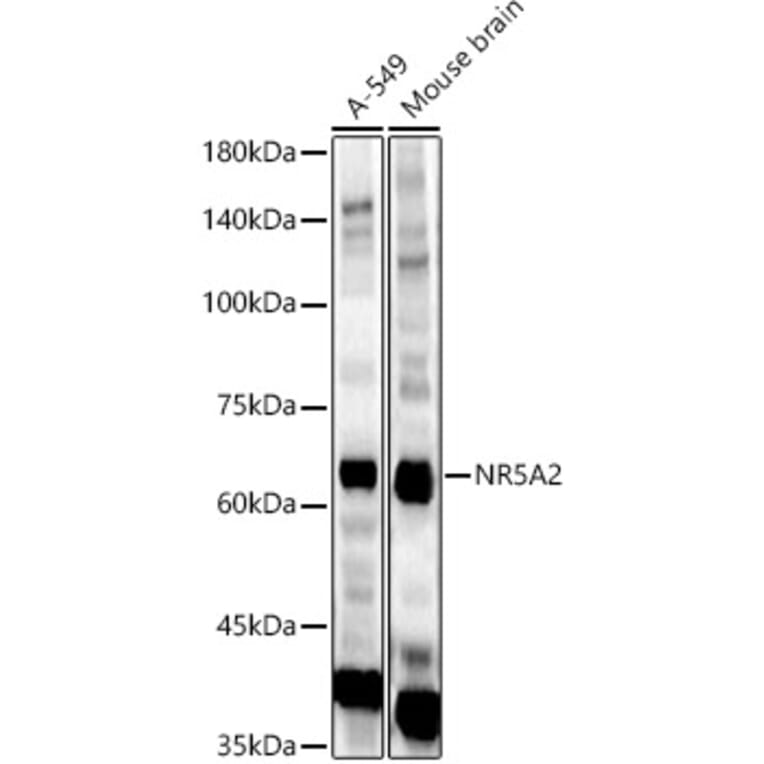 Western Blot - Anti-NR5A2/LRH1 Antibody (A14961) - Antibodies.com