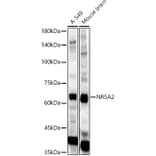 Western Blot - Anti-NR5A2/LRH1 Antibody (A14961) - Antibodies.com
