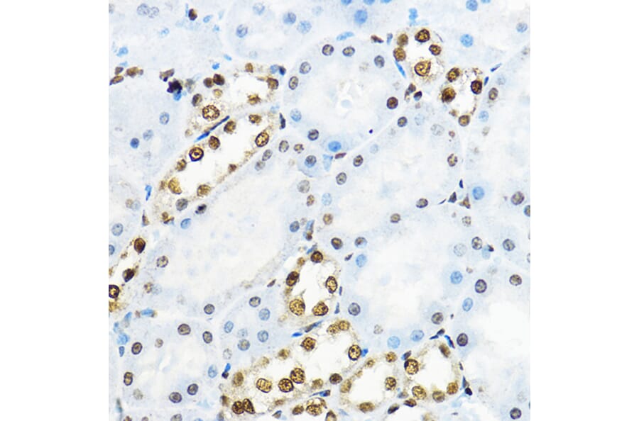 Immunohistochemistry - Anti-NR5A2/LRH1 Antibody (A14961) - Antibodies.com